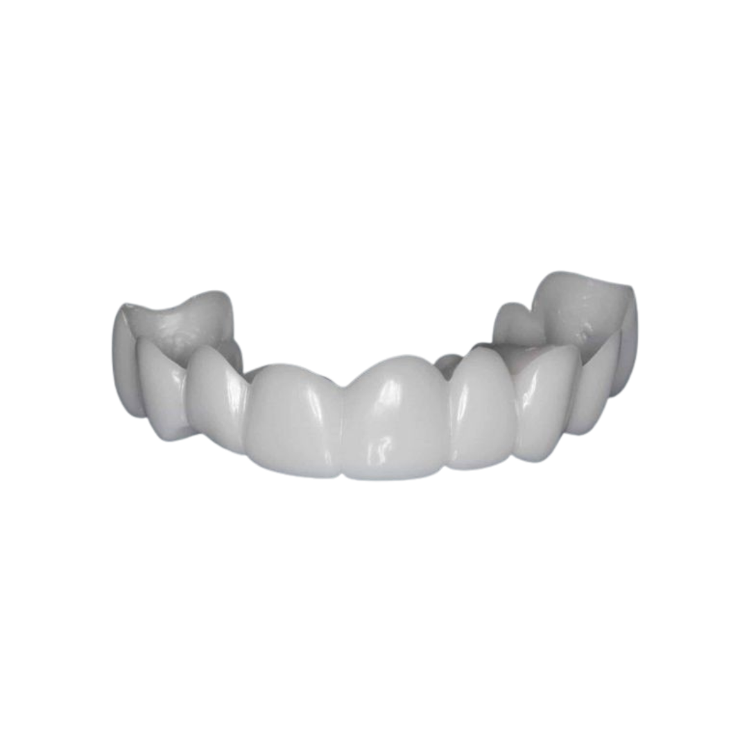 Dentora™ Snap-On Veneers