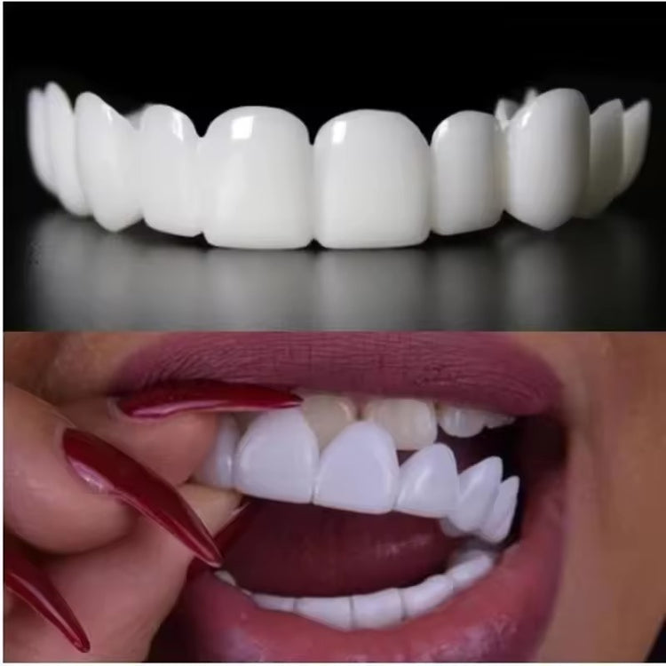 Dentora™ Snap-On Veneers